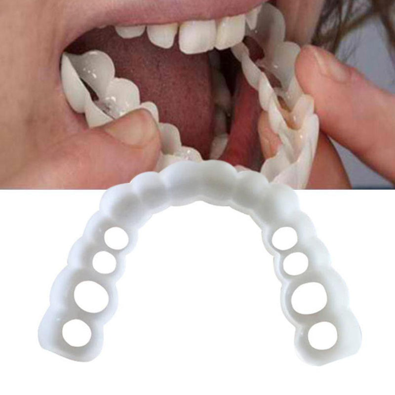 Facetas Odontológicas Removíveis - Snap On Smile - Preços ao Alcance